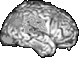 electric brain